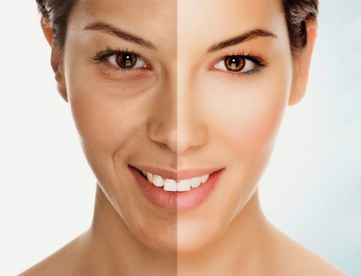 Tuổi 40 nên uống collagen loại nào để giảm nếp nhăn hiệu quả?